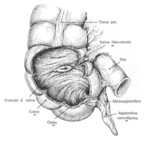 Appendicite che cos'è