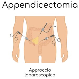 Appendicite-diagnosi